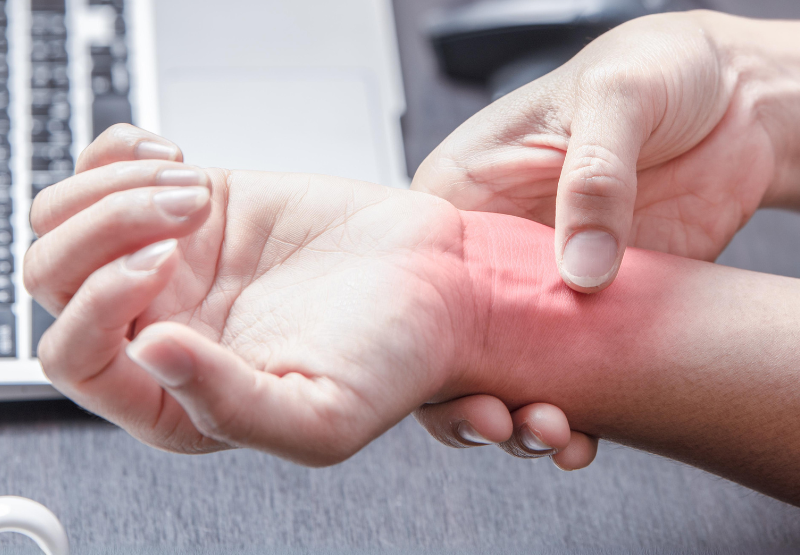 What is Carpal Tunnel Syndrome?